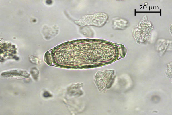 capillaria plica parassita