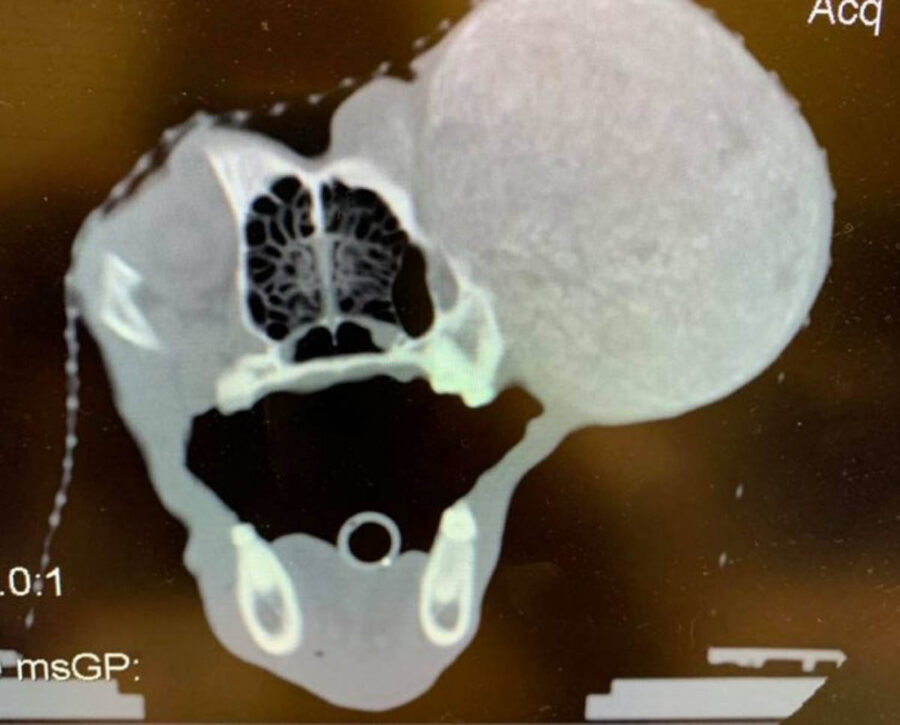 radiografia