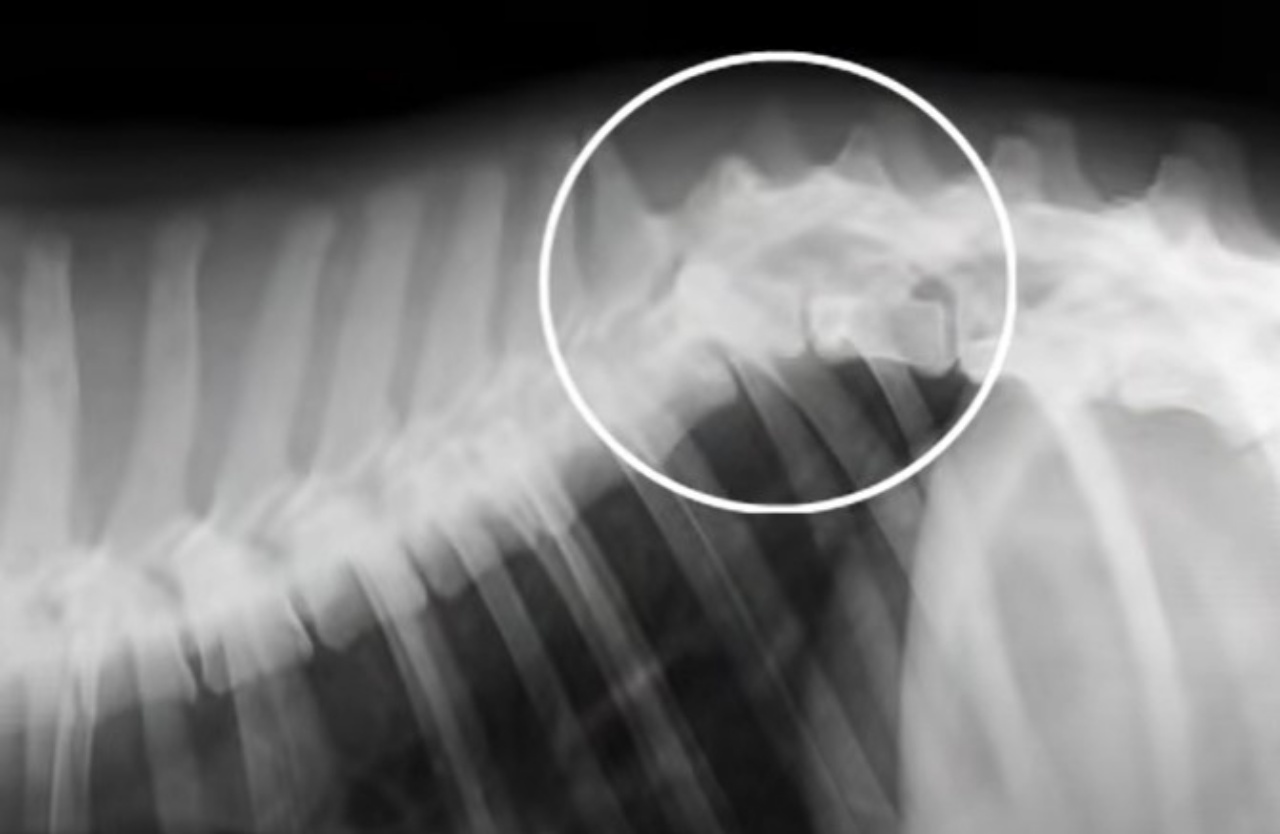 Radiografia colonna vertebrale